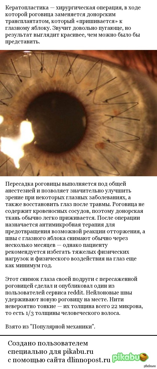 Как выглядит роговица глаза