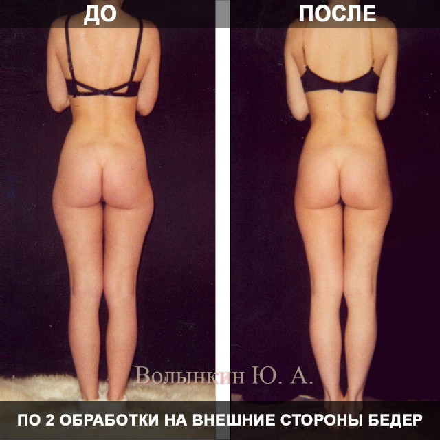 Ручная пластика – отдельное направление в эстетической медицине