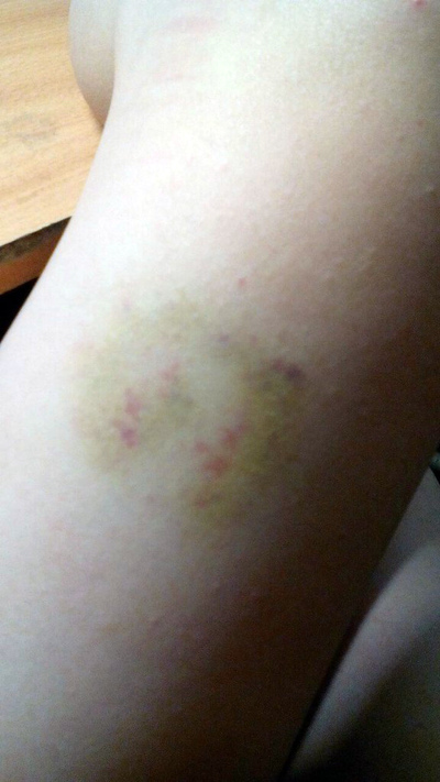 Иллюстрация к комментарию