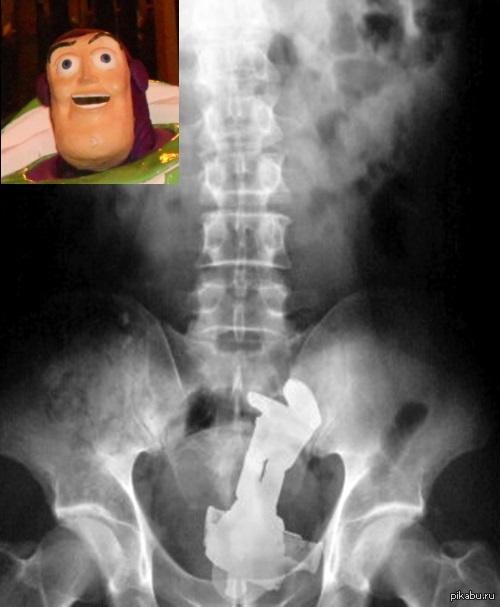     Buzz. To infinity and beyond!