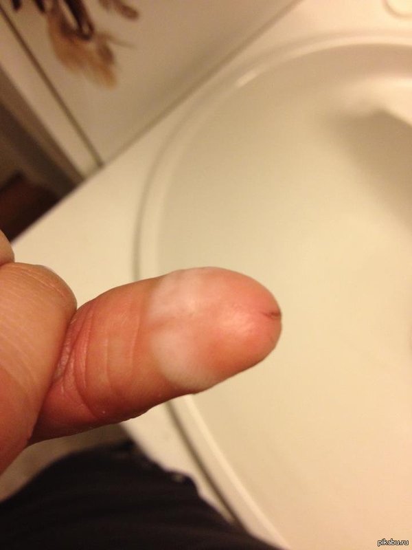cut my finger - NSFW, Finger, Coincidence, 