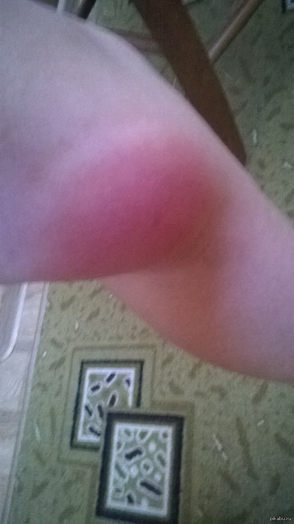 Вот это овод.....