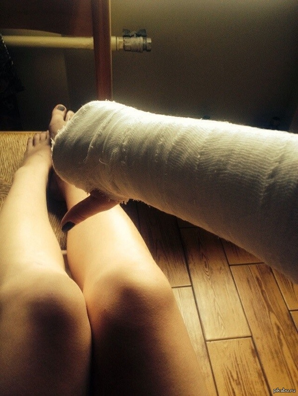 Последние три недели лета, а я сижу дома со сломанной рукой..