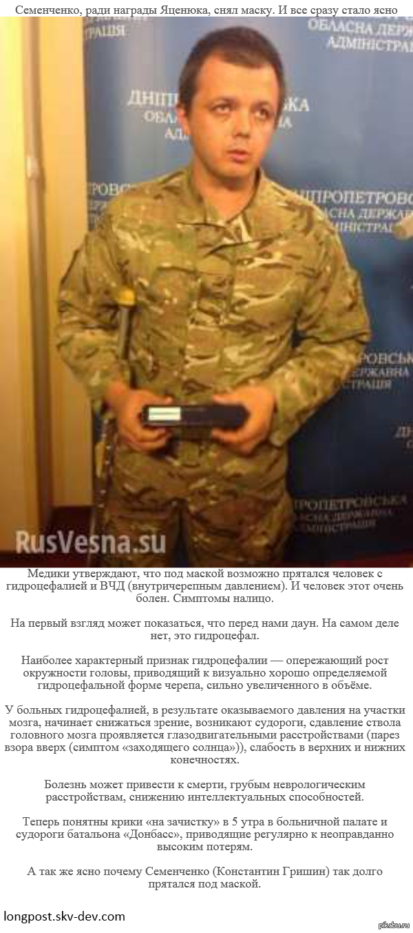 гидроцефал