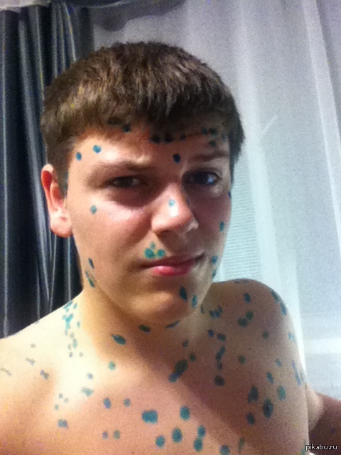 Осень. опять простуда? насморк достал? горло болит и температура? ну что сказать, бро, - мне тебя жаль...