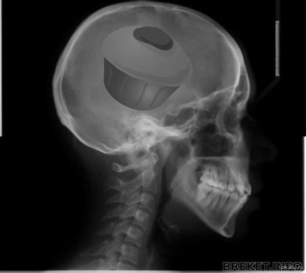 Пикабу головного мозга