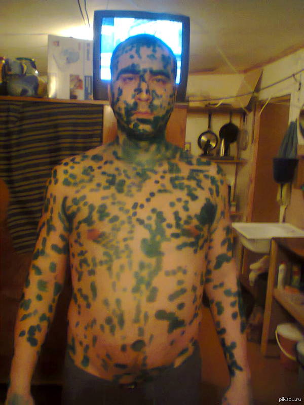 как я болел ветрянкой...