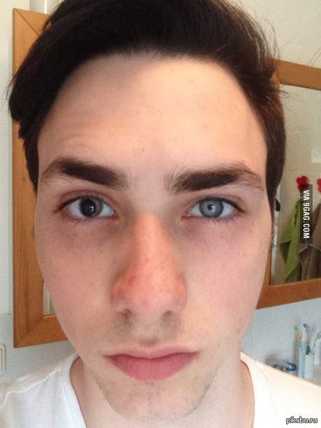 "Мой двоюродный брат нечаянно выстрелил мне карандашом из арбалета в правый глаз, когда мне было 10 лет"