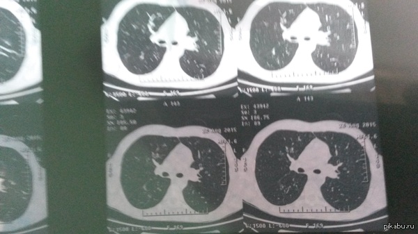 ������� �� �����, ������� �� ��� ���� ��������)