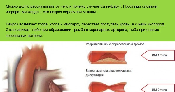 Инфаркт миокарда. Первая помощь. | Пикабу
