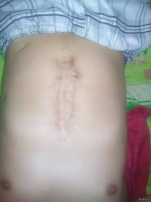 Нарисуйте идеи для тату вокруг шрама, а то я устал купаться в майке, на любую тему, спасибо