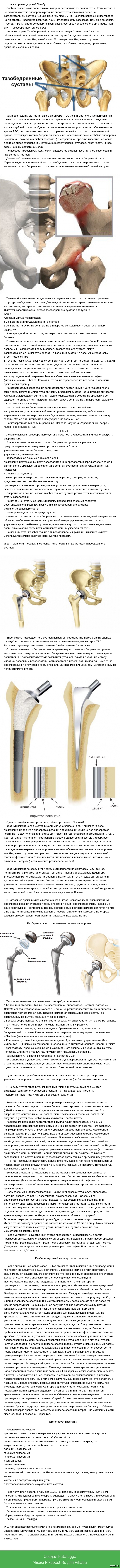 Эндопротезирование тазобедренного сустава. | Пикабу