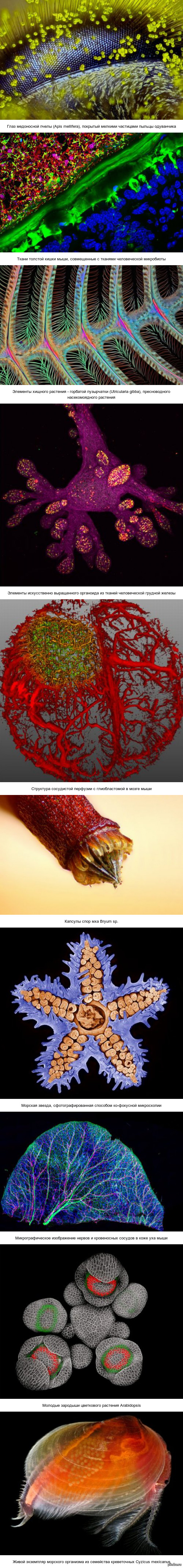 10 невероятных снимков микромира, которые стали победителями конкурса Nikon Small World 2015