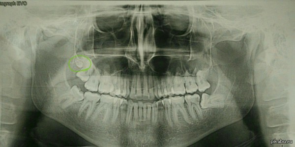 ������� �����, ��� � ������