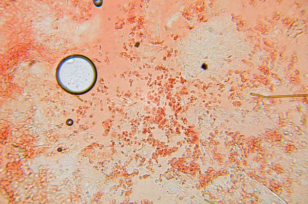 1450635419127297685 Как выглядит стекло под микроскопом