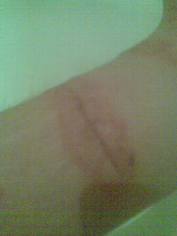 Медики есть? Я знаю-есть)