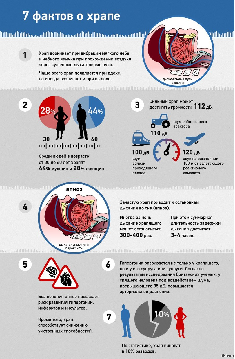 Инсульт во сне. Интересные факты о храпе. Факты о здоровье. Инфографика интересные факты. Инфографика факты о здоровье.