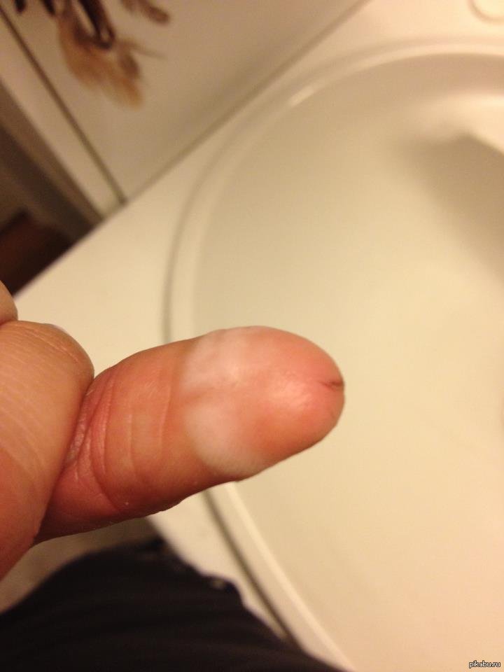 cut my finger - NSFW, Finger, Coincidence, Not a member