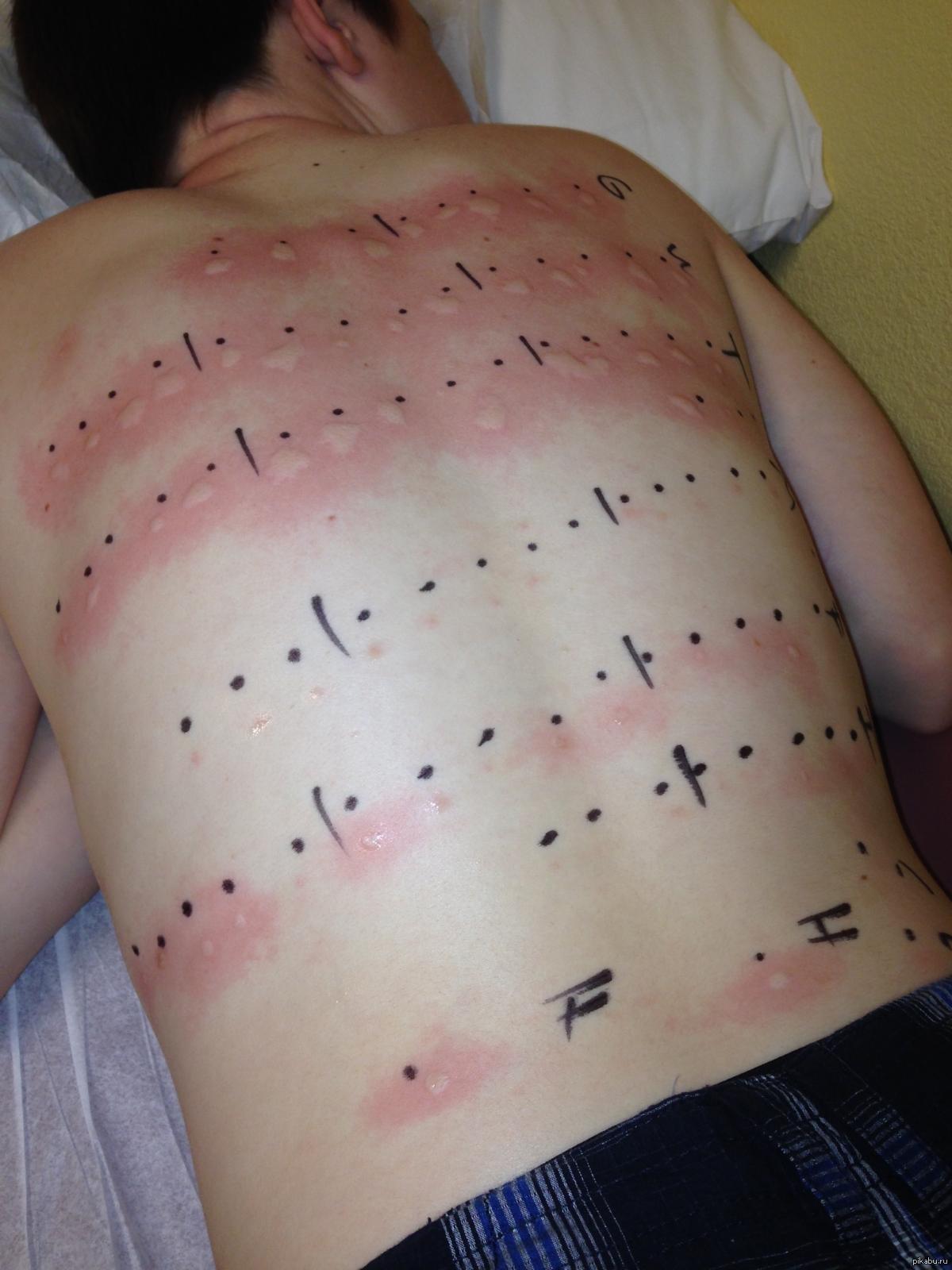 Красные точки на головке и зуд