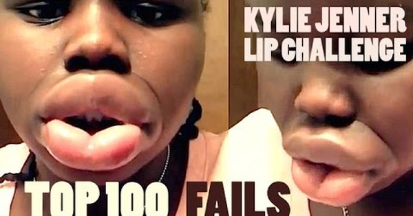 Fail 100