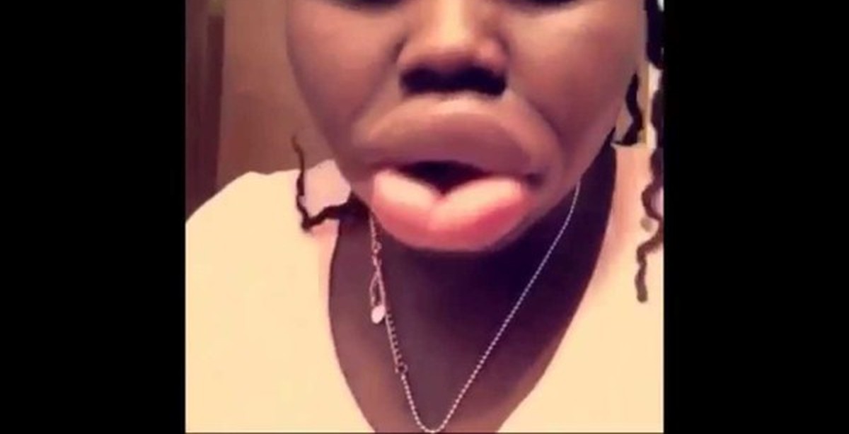 Lesbians With Big Lips